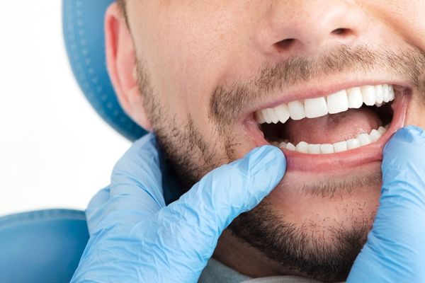 À quoi vous attendre une fois votre traitement orthodontique terminé