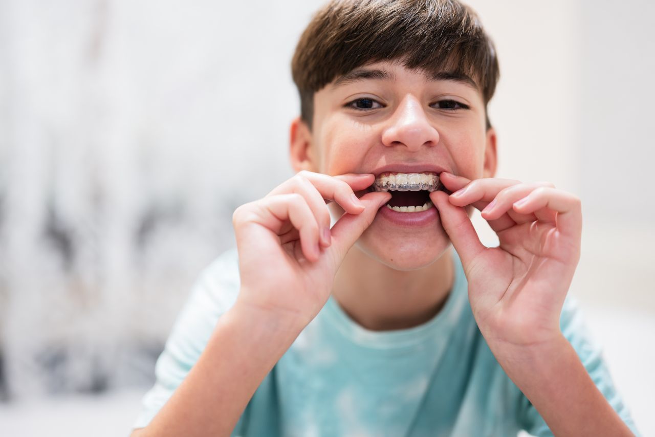 orthodontie pour adolescents - Clinique dorthodontie Pierre Messier a Saint-Jerome (1)