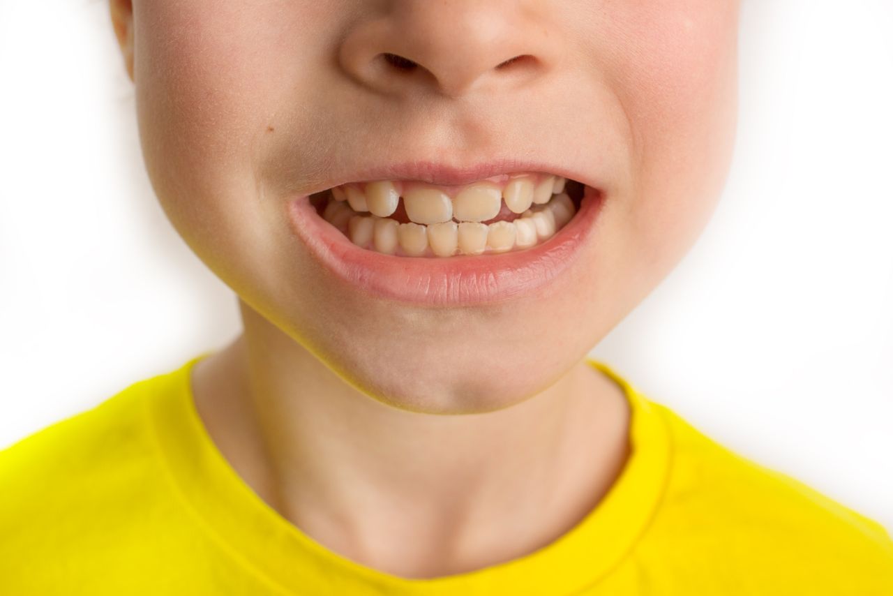Orthodontie pour enfants dans les Laurentides - Clinique d'orthodontie Pierre Messier à St-Jérôme