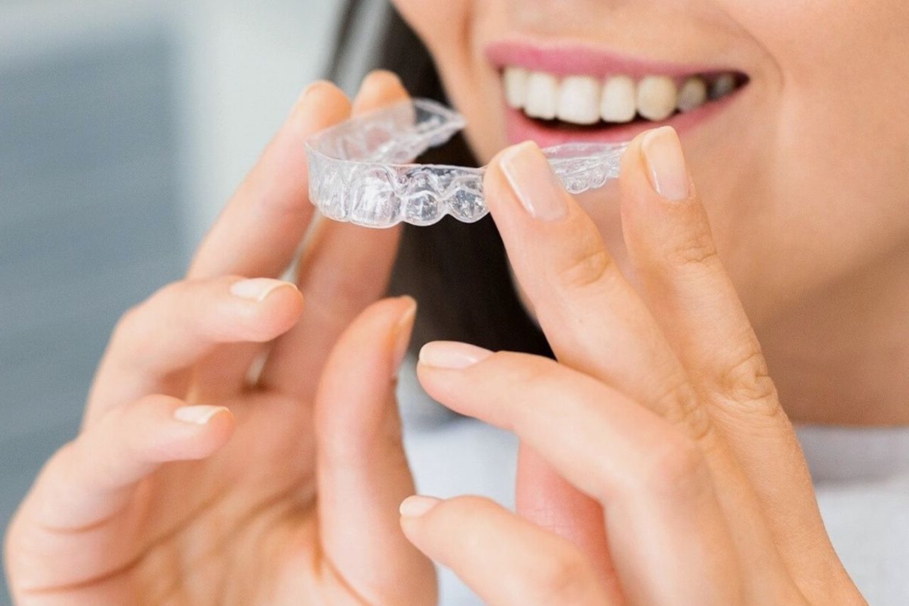 évaluation invisalign - Clinique d'orthodontie Pierre Messier